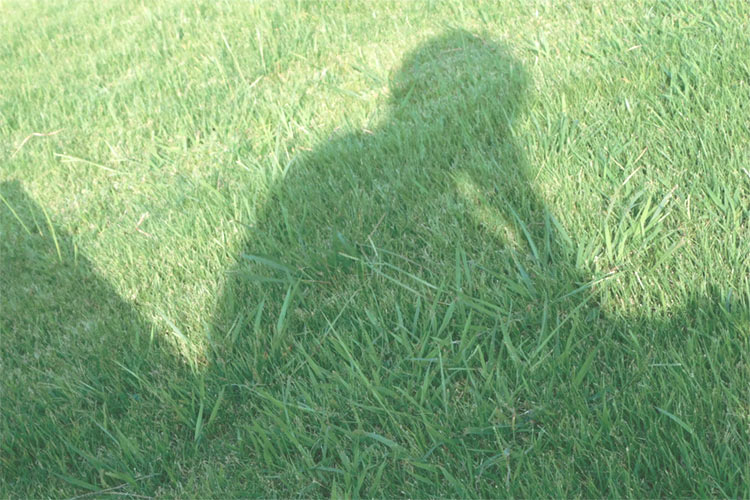 統合失調症画像